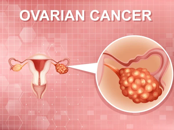 The Importance of Regular Check-ups: Monitoring Ovarian Cysts
