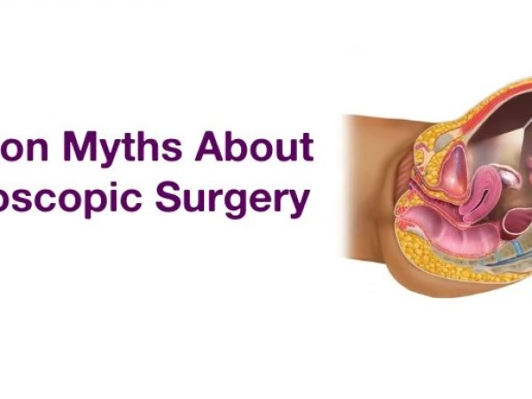 7 Common Myths About Laparoscopic Surgery And What’s Actually True