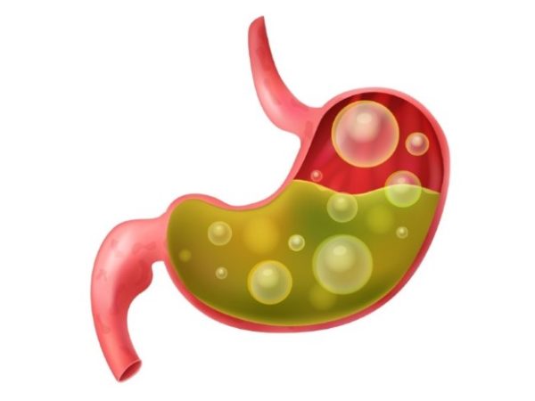 Effective Approaches to Managing Chronic Acid Reflux