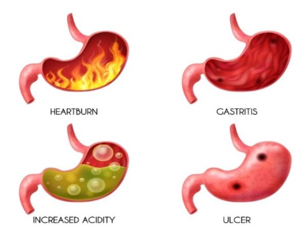 9 Methods To Treat Acid Reflux Naturally
