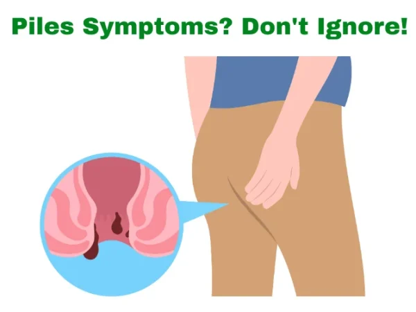Piles Symptoms: Early Signs, Types and When to See a Doctor