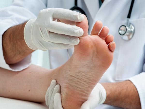 How Diabetic Foot Is Treated at Marina’s Clinic: Complete Care for Faster Healing
