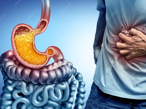 Beyond Antacids: When Chronic GERD and Severe Acid Reflux Require a Surgeon