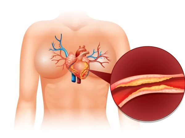 Peripheral Vascular Disease: Understanding the Symptoms and Risk Factors