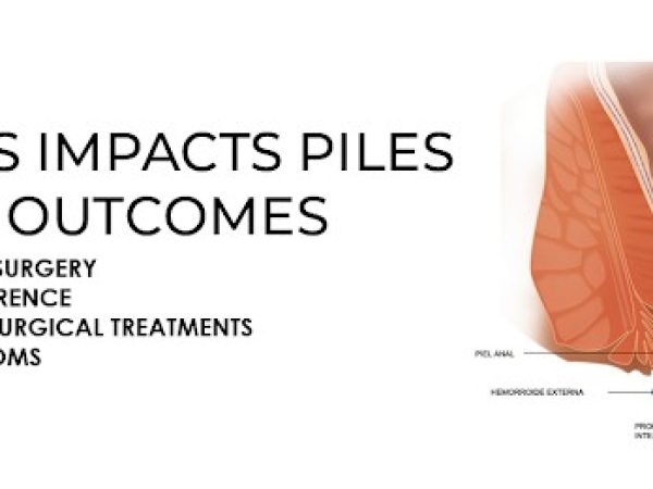 Common Myths About Varicose Veins: Debunking Misconceptions