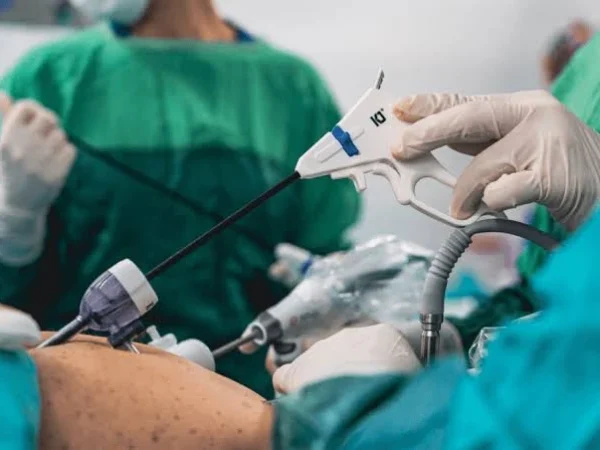 Laparoscopic Surgery Recovery: A Week-by-Week Timeline