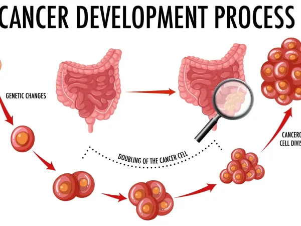 Exploring Lifestyle Changes to Reduce the Risk of Colorectal Cancer