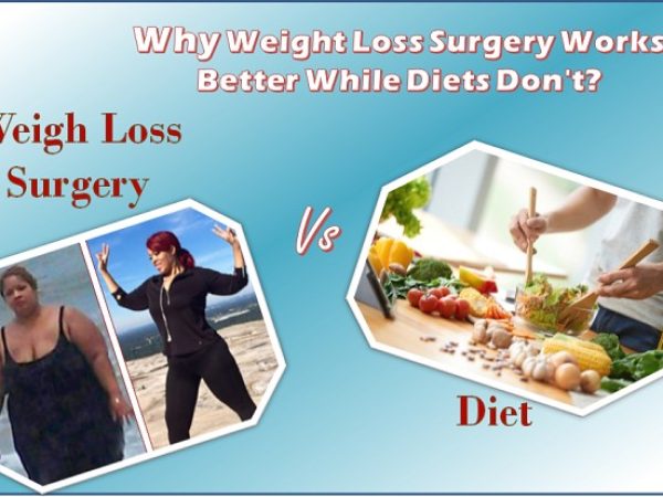 Surgery vs Diet & Exercise: What Actually Works Long-Term?